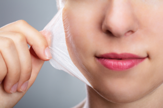 Peeling Viso Avezzano