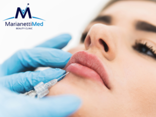 Filler Labbra Avezzano 