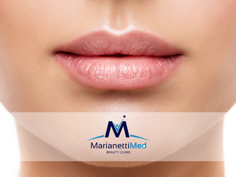 Filler-Labbra-Avezzano.png