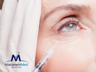 Filler e Botox Avezzano Estate 2 