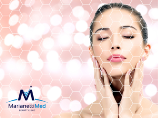 Medicina Estetica Avezzano Filler Botox Estate