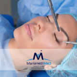 Blefaroplastica Marianetti