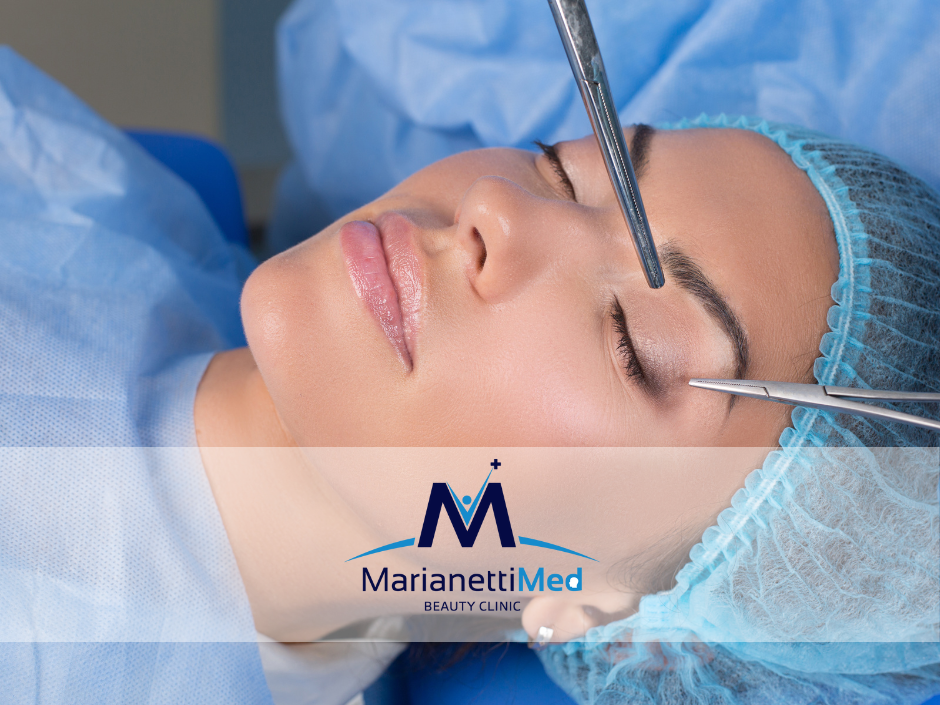 Blefaroplastica-MarianettiMED.png